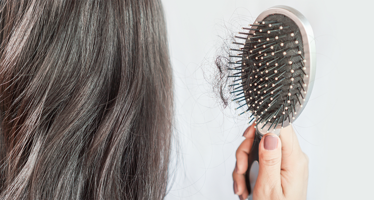 Hair Loss In Menopause: Causes, Testing, and Treatments